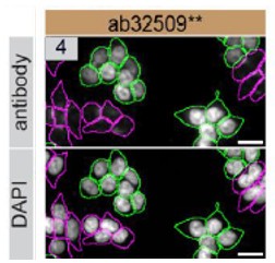 Immunocytochemistry/ Immunofluorescence - Anti-p53 antibody [E47] (AB32509)