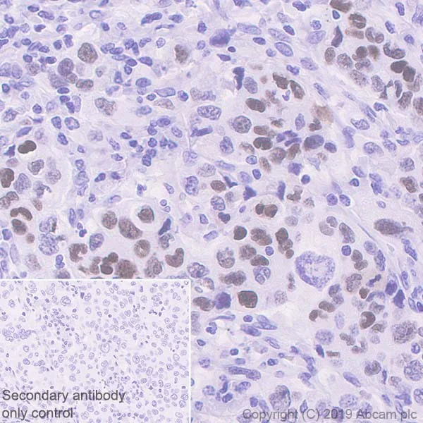 Immunohistochemistry (Formalin/PFA-fixed paraffin-embedded sections) - Anti-p53 antibody [E47] (AB32509)