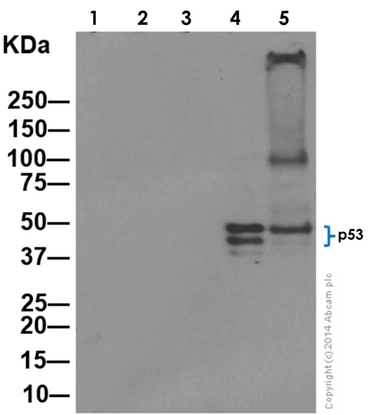 Western blot - Anti-p53 antibody [E47] (AB32509)