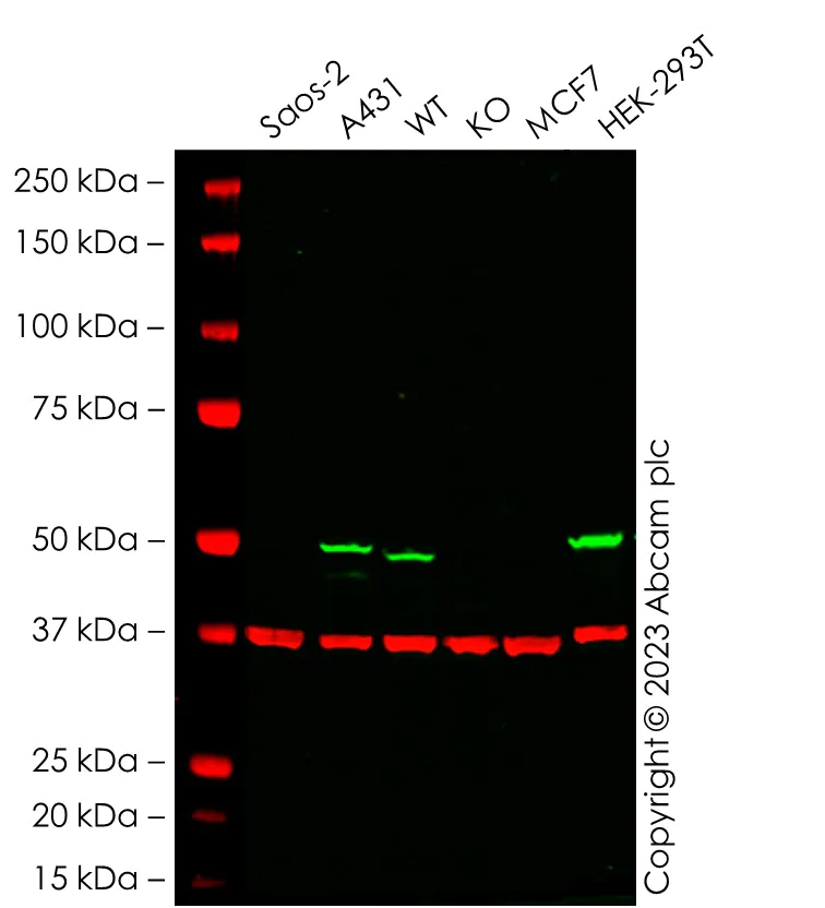 Western blot - Anti-p53 antibody [E47] (AB32509)