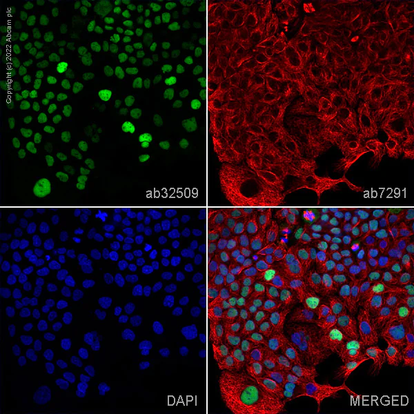 Immunocytochemistry/ Immunofluorescence - Anti-p53 antibody [E47] - BSA and Azide free (AB247264)