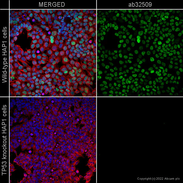 Immunocytochemistry/ Immunofluorescence - Anti-p53 antibody [E47] - BSA and Azide free (AB247264)