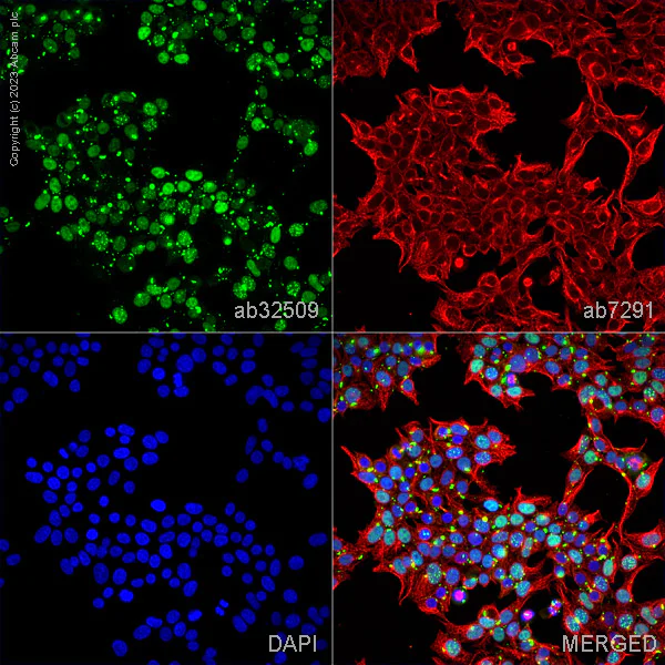 Immunocytochemistry/ Immunofluorescence - Anti-p53 antibody [E47] - BSA and Azide free (AB247264)