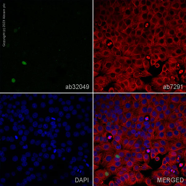 Immunocytochemistry/ Immunofluorescence - Anti-p53 antibody [E47] - BSA and Azide free (AB247264)