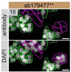 Immunocytochemistry/ Immunofluorescence - Anti-p53 antibody [EPR17343] (AB179477)