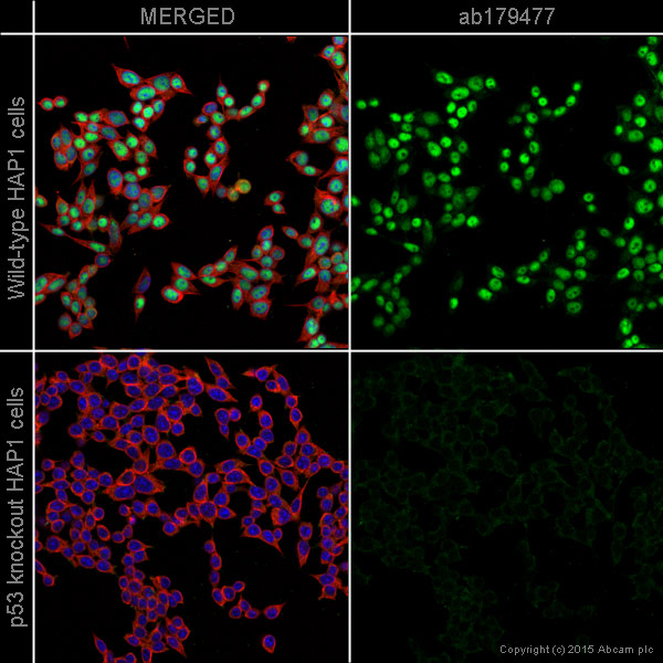 Immunocytochemistry/ Immunofluorescence - Anti-p53 antibody [EPR17343] (AB179477), expandable thumbnail