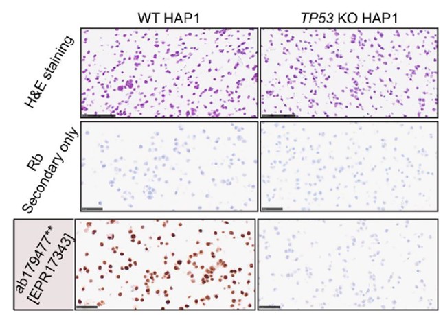 Immunohistochemistry (Formalin/PFA-fixed paraffin-embedded sections) - Anti-p53 antibody [EPR17343] (AB179477)