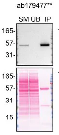 Immunoprecipitation - Anti-p53 antibody [EPR17343] (AB179477)