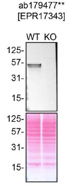 Western blot - Anti-p53 antibody [EPR17343] (AB179477)
