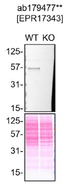 Western blot - Anti-p53 antibody [EPR17343] (AB179477)