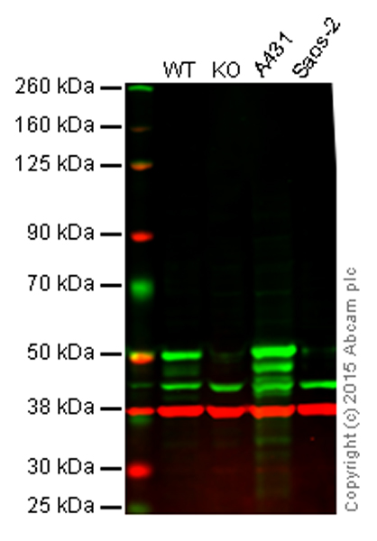Western blot - Anti-p53 antibody [EPR17343] (AB179477), expandable thumbnail