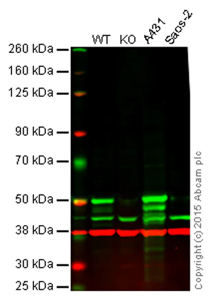 Western blot - Anti-p53 antibody [EPR17343] (AB179477)