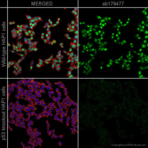Immunocytochemistry/ Immunofluorescence - Anti-p53 antibody [EPR17343] - BSA and Azide free (AB240215)