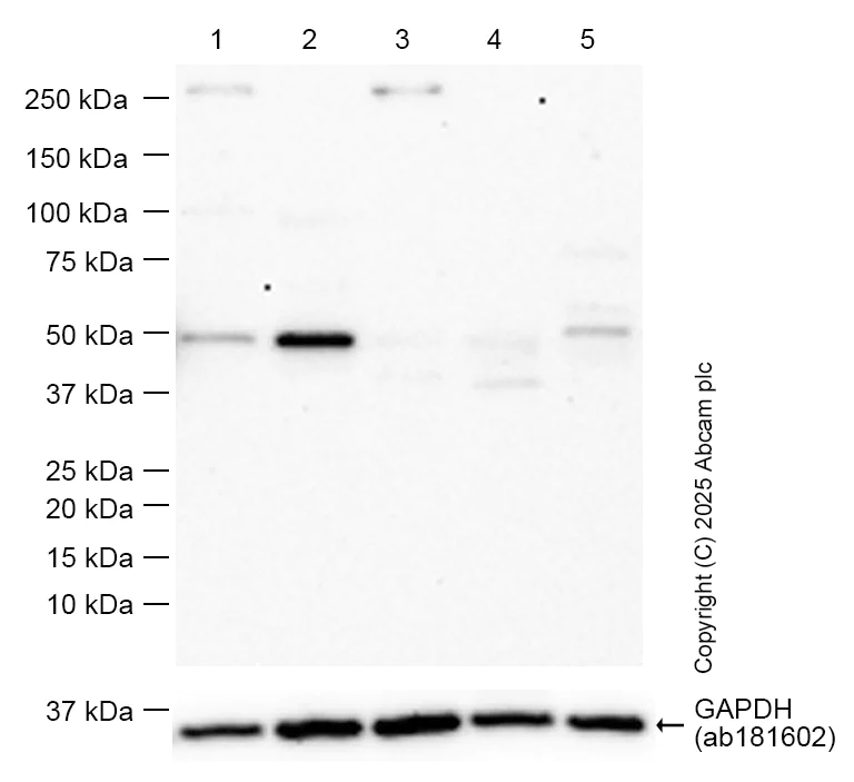 Western blot - Anti-p53 antibody [EPR20416-117] (AB211020)