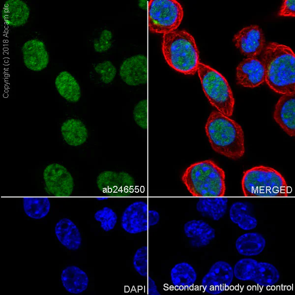 Immunocytochemistry/ Immunofluorescence - Anti-p53 antibody [EPR20416-120] (AB246550)