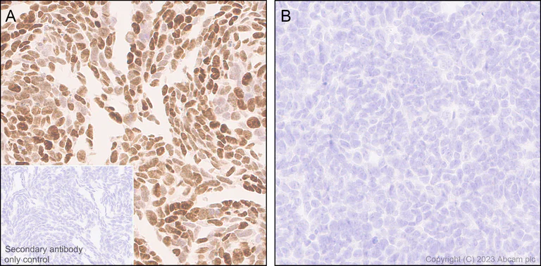 Immunohistochemistry (Formalin/PFA-fixed paraffin-embedded sections) - Anti-p53 antibody [G59-12] (AB308609)