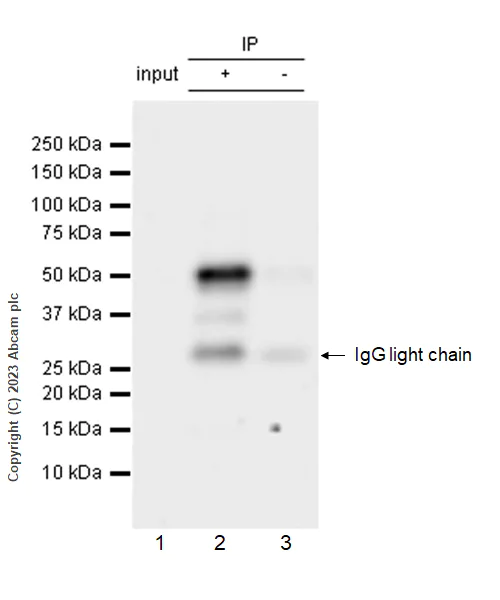 Immunoprecipitation - Anti-p53 antibody [G59-12] (AB308609)