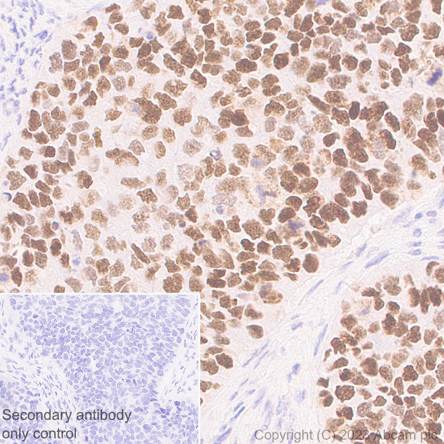 Immunohistochemistry (Formalin/PFA-fixed paraffin-embedded sections) - Anti-p53 antibody [G59-12] - BSA and Azide free (AB308610), expandable thumbnail