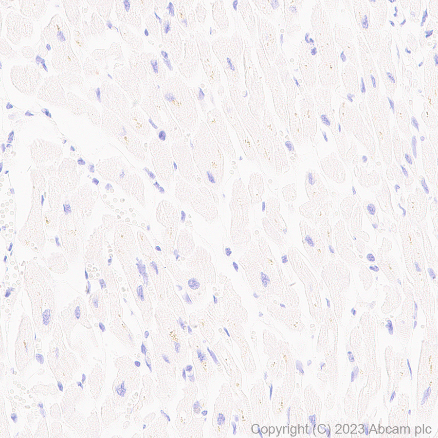 Immunohistochemistry (Formalin/PFA-fixed paraffin-embedded sections) - Anti-p53 antibody [G59-12] - BSA and Azide free (ab308610), expandable thumbnail
