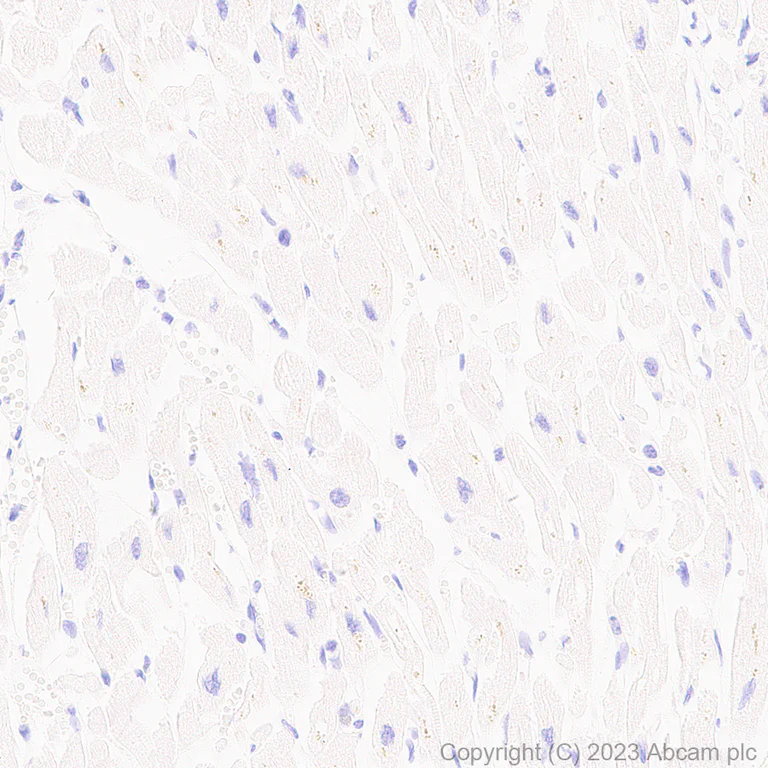 Immunohistochemistry (Formalin/PFA-fixed paraffin-embedded sections) - Anti-p53 antibody [G59-12] - BSA and Azide free (AB308610)