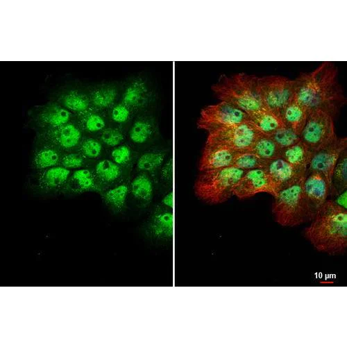 Immunocytochemistry/ Immunofluorescence - Anti-p53 antibody [HL2242] (AB317176)