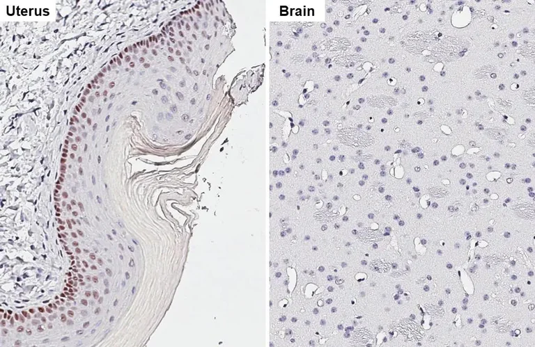 Immunohistochemistry (Formalin/PFA-fixed paraffin-embedded sections) - Anti-p53 antibody [HL2242] (AB317176)