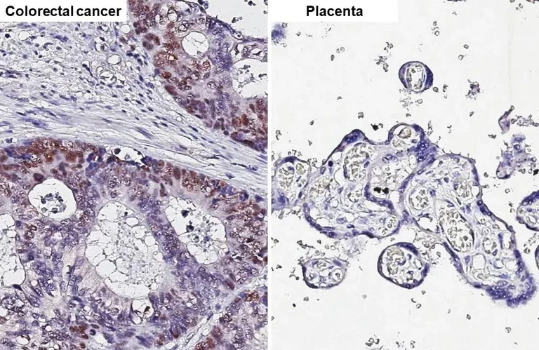 Immunohistochemistry (Formalin/PFA-fixed paraffin-embedded sections) - Anti-p53 antibody [HL2242] (AB317176)