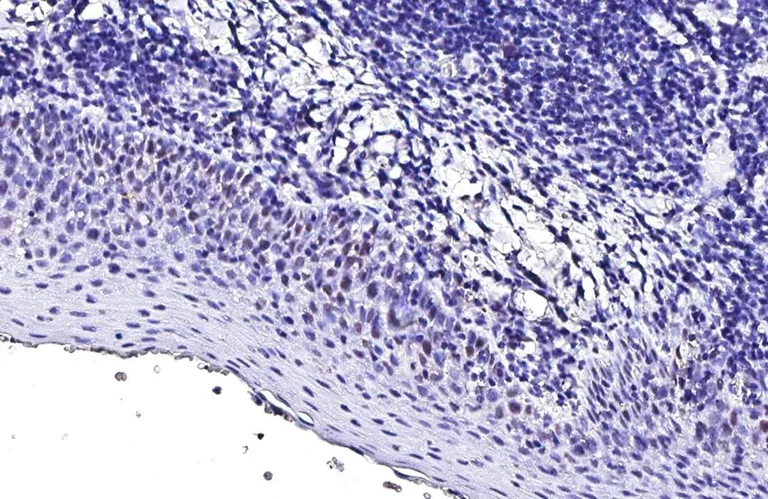 Immunohistochemistry (Formalin/PFA-fixed paraffin-embedded sections) - Anti-p53 antibody [HL2242] (AB317176)