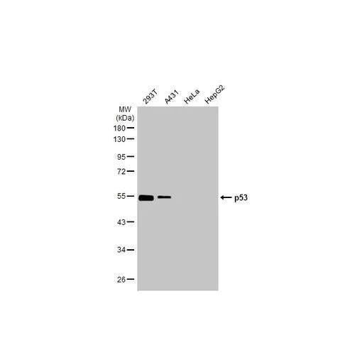 Western blot - Anti-p53 antibody [HL2242] (AB317176)
