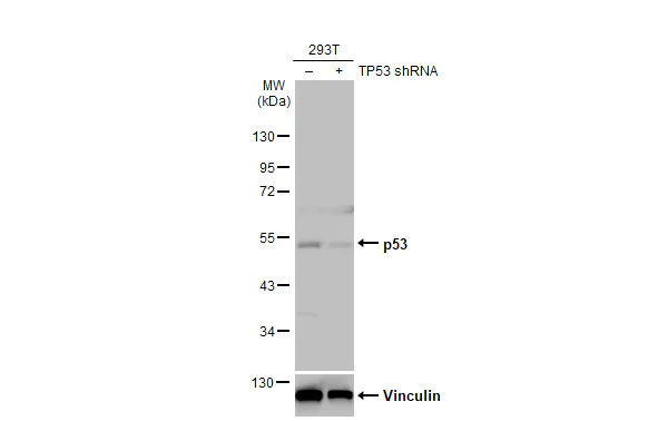 Western blot - Anti-p53 antibody [HL2242] (AB317176)