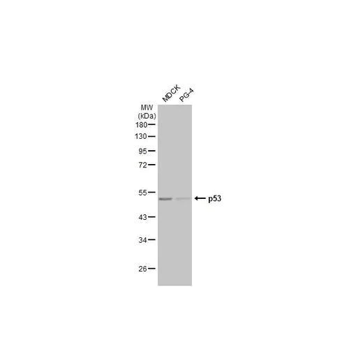 Western blot - Anti-p53 antibody [HL2242] (AB317176)
