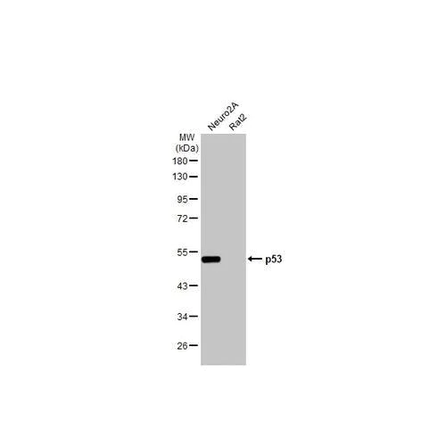 Western blot - Anti-p53 antibody [HL2242] (AB317176)