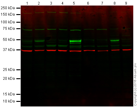 Western blot - Anti-p53 antibody [PAb 1801] (AB28), expandable thumbnail
