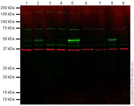 Western blot - Anti-p53 antibody [PAb 1801] (AB28)