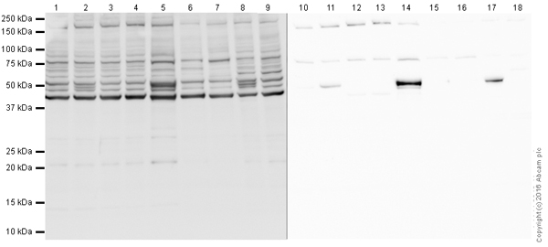 Western blot - Anti-p53 antibody [PAb 1801] (AB28), expandable thumbnail
