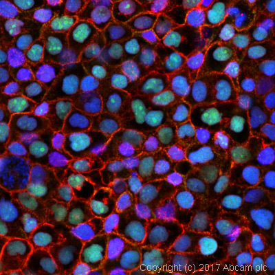 Immunocytochemistry/ Immunofluorescence - Anti-p53 antibody [PAb 240] (AB26), expandable thumbnail