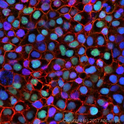 Immunocytochemistry/ Immunofluorescence - Anti-p53 antibody [PAb 240] (AB26)