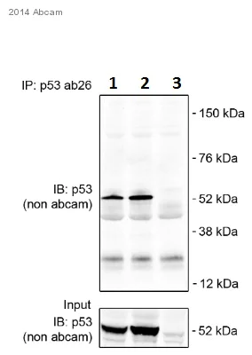 Immunoprecipitation - Anti-p53 antibody [PAb 240] (AB26)