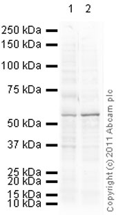 Western blot - Anti-p53 antibody [PAb 240] (ab26), expandable thumbnail