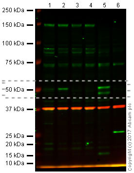 Western blot - Anti-p53 antibody [PAb 240] (AB26), expandable thumbnail