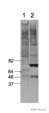 Western blot - Anti-p53 antibody [PAb 240] (AB26), expandable thumbnail