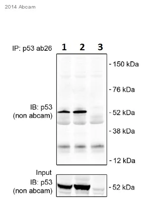 Immunoprecipitation - Anti-p53 antibody [PAb 240] - BSA and Azide free (AB176243)