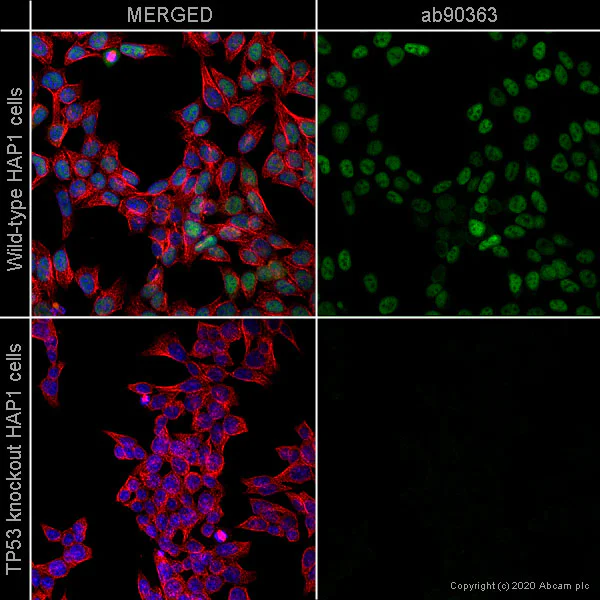 Immunocytochemistry/ Immunofluorescence - Anti-p53 antibody [pAb122] (AB90363)