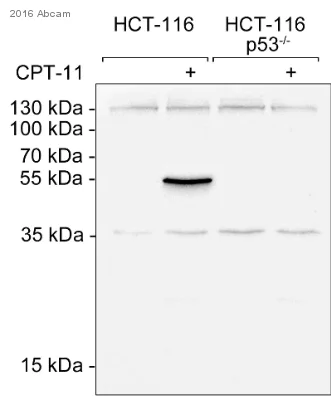 Western blot - Anti-p53 antibody [pAb122] (AB90363)