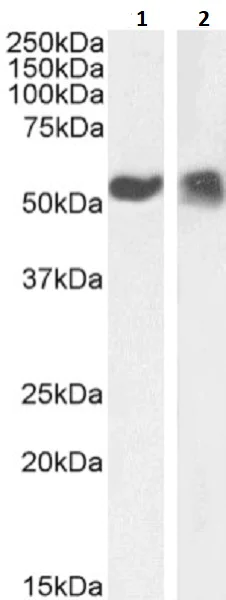 Western blot - Anti-p53 antibody [PAb421] (AB245685)