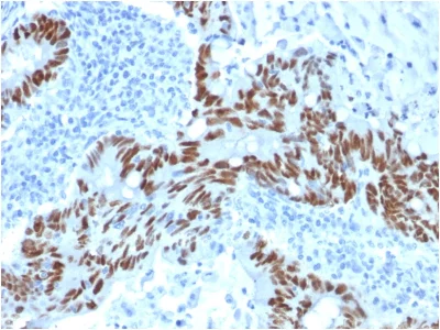 Immunohistochemistry (Formalin/PFA-fixed paraffin-embedded sections) - Anti-p53 antibody [PCRP-TP53-1F7] - BSA and Azide free (AB237918)