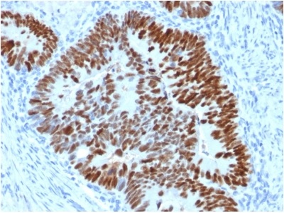 Immunohistochemistry (Formalin/PFA-fixed paraffin-embedded sections) - Anti-p53 antibody [PCRP-TP53-2A10] - BSA and Azide free (AB237917), expandable thumbnail