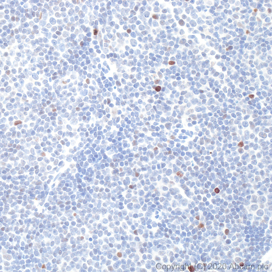 Immunohistochemistry (Formalin/PFA-fixed paraffin-embedded sections) - Anti-p53 antibody [POE316A] (AB241566), expandable thumbnail