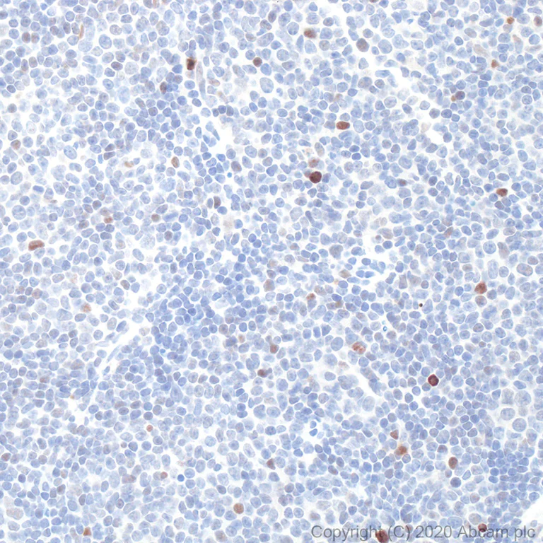 Immunohistochemistry (Formalin/PFA-fixed paraffin-embedded sections) - Anti-p53 antibody [POE316A] - BSA and Azide free (AB252786)