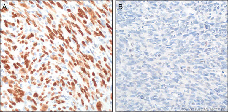 Immunohistochemistry (Formalin/PFA-fixed paraffin-embedded sections) - Anti-p53 antibody [POE316A] - BSA and Azide free (AB252786)
